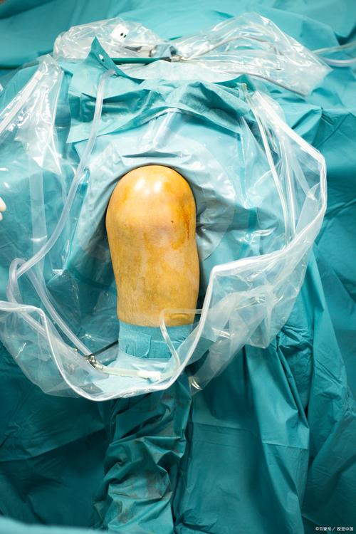 接受膝盖手术！专家谈加维：手术能更好保护膝关节但需长时间恢复