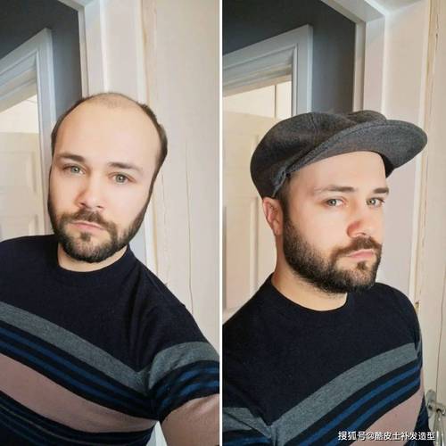 太阳报:前美国国脚多诺万为脱发苦恼,向粉丝求助帮忙挑假发