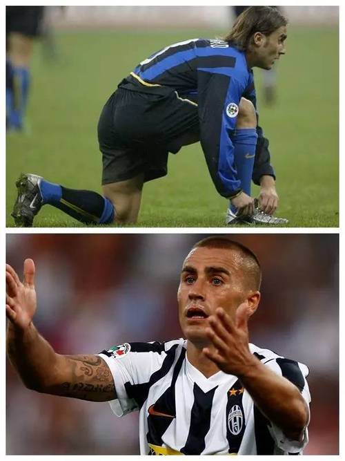 今日趣图：卡纳瓦罗——我就说植发后的头发在头上待不了几年